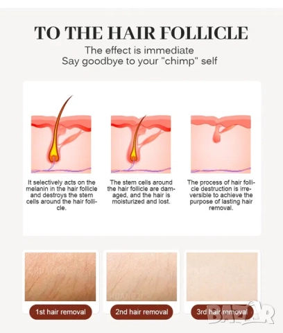 Диоден лазерен епилатор с охлаждане Soprano, 3 дължини на вълната, 3000W/4000W, снимка 12 - Козметични уреди - 52083757