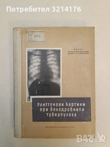 Рентгенови картини при белодробната туберкулоза – Колектив (1957)