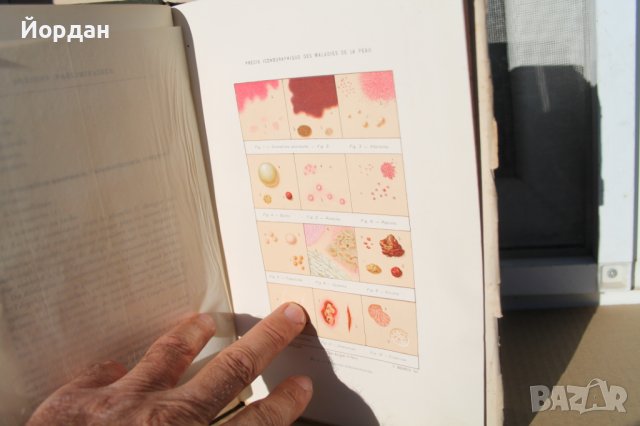 Френска медицинска книга за кожни заболявания, снимка 7 - Специализирана литература - 42654446