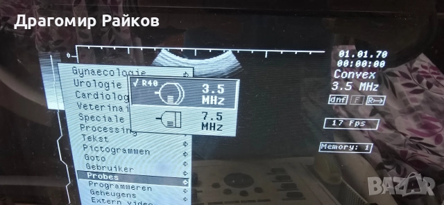 Ултразвуков апарат Philips ултразвук ехограф, снимка 3 - Друга електроника - 52961953