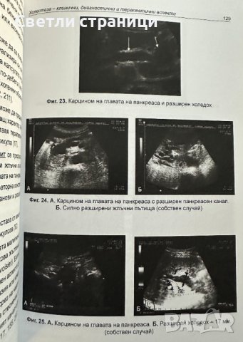 Холестаза. Клинични, диагностични и терапевтични аспекти, снимка 4 - Специализирана литература - 44199965