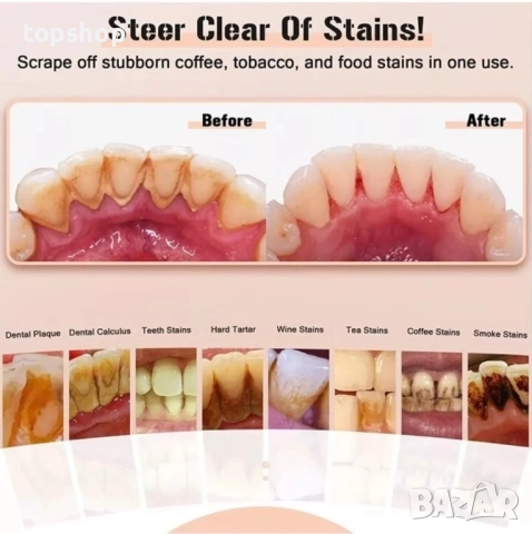 Комплект за премахване на зъбен камък, акумулаторен, комплект за премахване на плака/петна/LED ..., снимка 6 - Друга електроника - 51637920