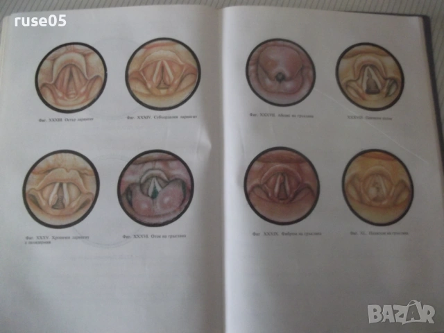 Книга "Ушни носни и гърлени болести - Вл. Павлов" - 296 стр., снимка 7 - Учебници, учебни тетрадки - 53218944