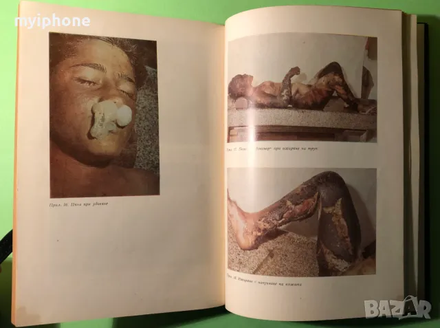 Книга Ръководство Практически Упражнения Съдебна Медицина, снимка 5 - Специализирана литература - 49279679