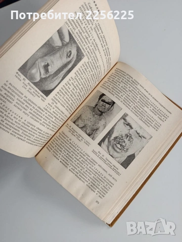 Патологична анатоми, снимка 2 - Специализирана литература - 53124750