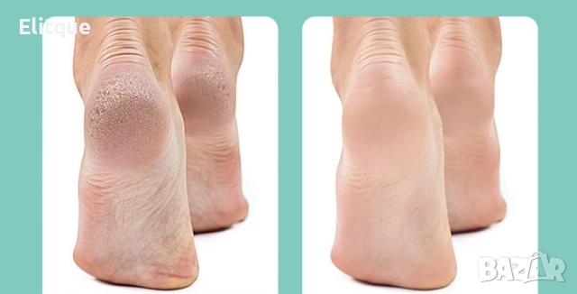 Електрически уред за премахване на мъртва кожа от петите, снимка 2 - Електрически пили за пети - 52861366