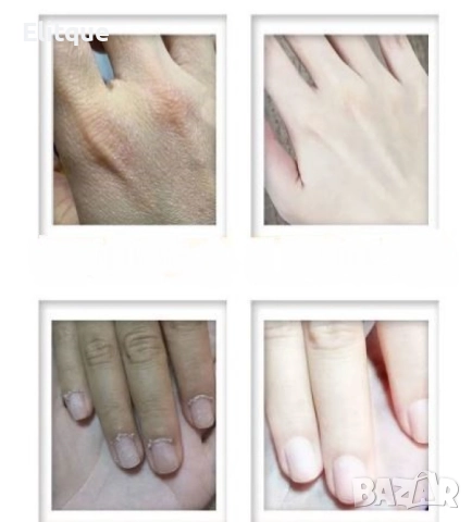 Крем за ръце с хиалуронова киселина HZS466, снимка 8 - Други - 52831766