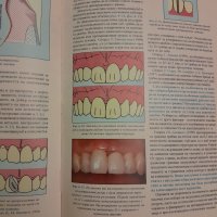 Изпиляване на зъбите за керамични и металокерамични коронки - Христо Кисов,  2000г., 186стр., снимка 11 - Специализирана литература - 42555084