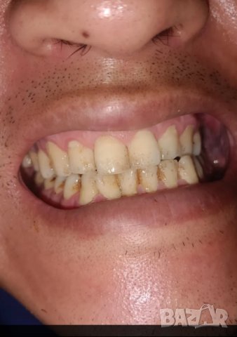 Избелваща паста за зъби за емайл и блясък , снимка 11 - Други - 41901926