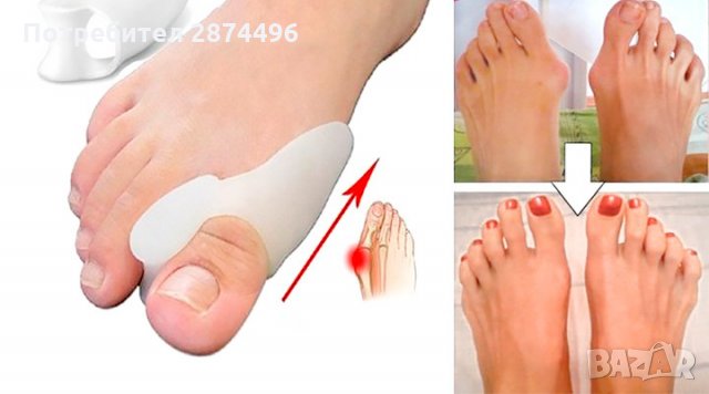 Силиконов разделител за кокалче за крака, снимка 3 - Други стоки за дома - 30912647