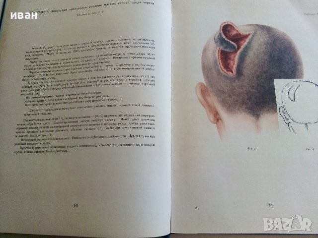 Атлас огнестрельных ранений - том 1 - 1948г. , снимка 6 - Специализирана литература - 42221033