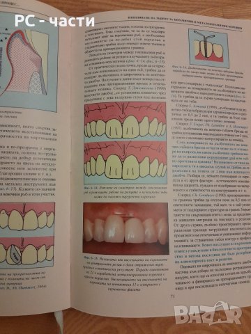 Изпиляване на зъбите за керамични и металокерамични коронки - Христо Кисов,  2000г., 186стр., снимка 11 - Специализирана литература - 42555084