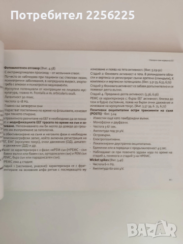 АТЛАС по електроенцефалография при възрастни - от норма към патология, снимка 3 - Специализирана литература - 51792642