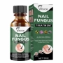 Лак на маслена основа против гъбички по ноктите 30ml, снимка 9