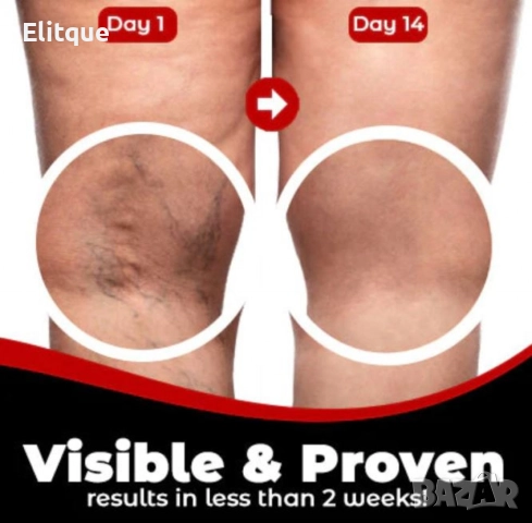 Здравен пластир за лечение на разширени вени Varicose Care Health Patch 12бр, снимка 3 - Други - 52594792