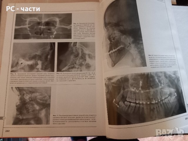Лицево-челюстна Хирургия - Атлас с рентгенографии Рабухина, Аржанцев, 2002 год., снимка 6 - Специализирана литература - 43953146