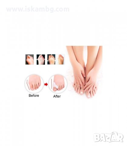 СИЛИКОНОВИ РАЗДЕЛИТЕЛИ СРЕЩУ ИЗПЪКНАЛИ КОКАЛЧЕТА - код FOOTMATE, снимка 2 - Други - 34061198