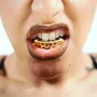 Grillz - Тип цялостен ( Рапърски зъби , Хип хоп зъби ), снимка 3