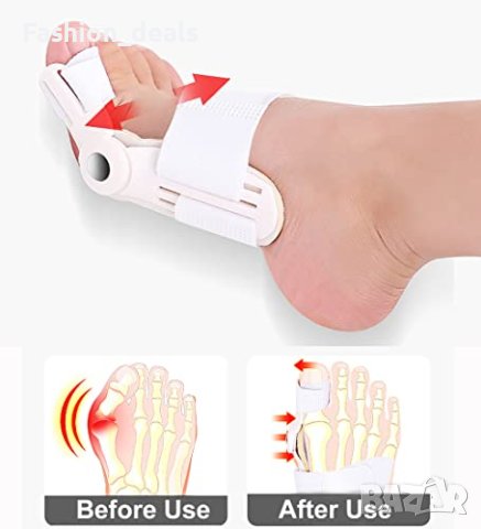 Нов Разделител за пръстите на краката Сепаратор за Изправяне Шина, снимка 4 - Други - 40283179