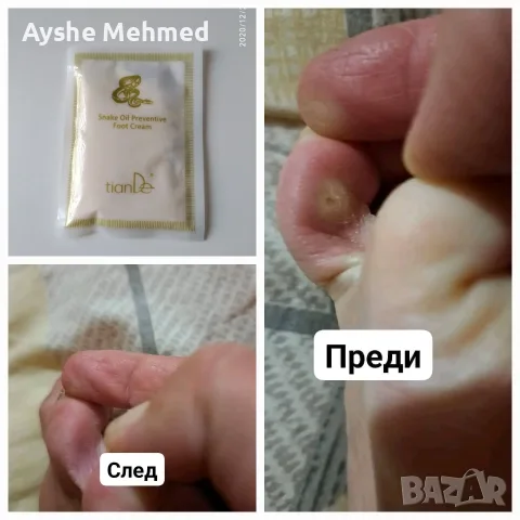 кажи сбогом на кокоши трън с змийска мас