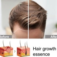 Японски спрей за растеж и сгъстяване на косата , снимка 4 - Продукти за коса - 42907704
