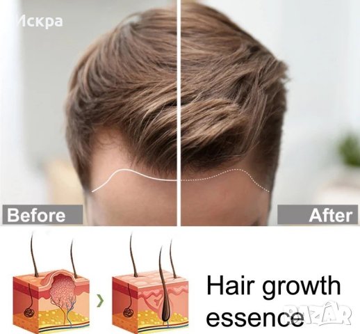 Японски спрей за растеж и сгъстяване на косата , снимка 4 - Продукти за коса - 42907704