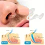 Силиконова щипка за нос против хъркане 2бр., снимка 3