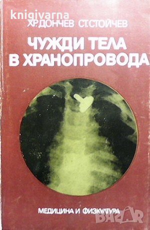 Чужди тела в хранопровода Хр. Дончев, снимка 1