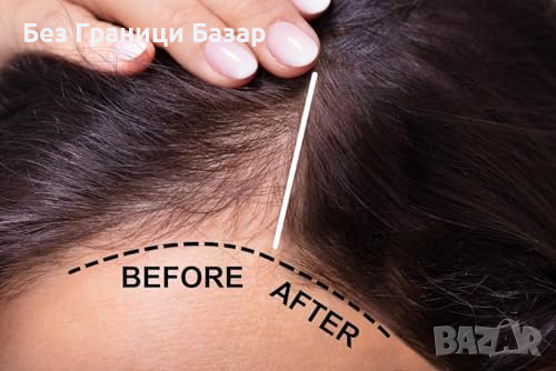 Ново за Борба с Косопада и Растеж на Коса - HAIRMETTO Серум и Дермаролер, снимка 6 - Продукти за коса - 44681436