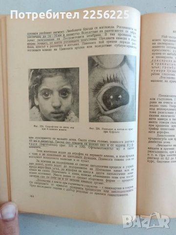 Учебник по очни болести, снимка 8 - Специализирана литература - 47490158
