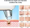 Уред за почистване на черни точки и грижа за лицено Yobuno Blackhead Remover Y002, снимка 5