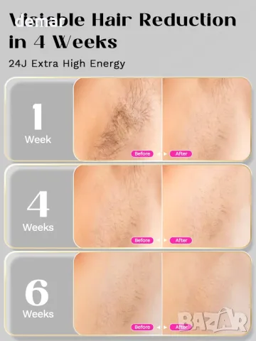 Устройство за лазерна епилация Wavytalk, IPL епилация, черно, снимка 2 - Епилатори - 47761938