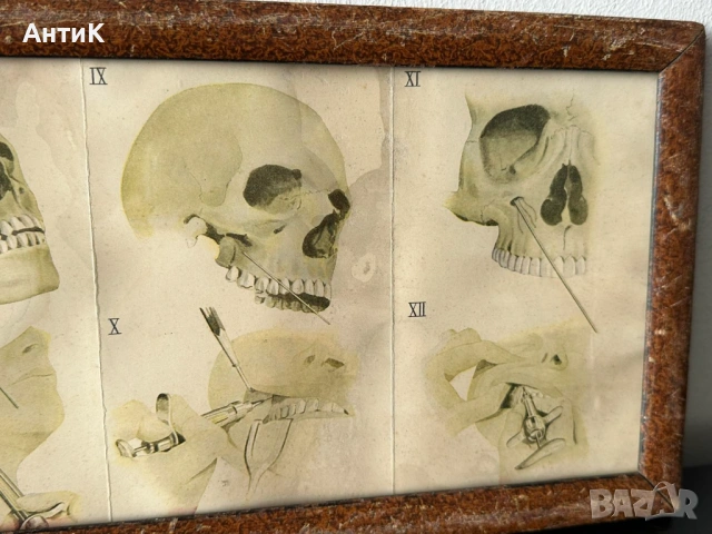 Медицинско Табло Брошура BAYER , снимка 6 - Антикварни и старинни предмети - 54249688