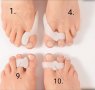 Изпъкнали кокалчета ”hallux valgus”-различни видове, снимка 7