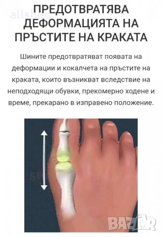 Силиконови шини за коригиране на пръстите на краката Hallux, снимка 3 - Шини - 31970879
