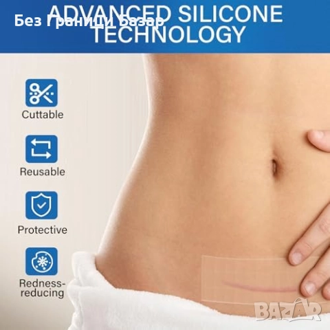 Нов Медицински силикон против белези за жени — дълга и многократна лента, снимка 5 - Други - 51938555