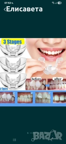 Ортодонтски коректор за зъби, снимка 7 - Козметика за лице - 51162870