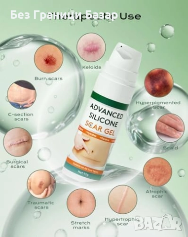 Нов Силиконов гел за белези 15g – операции, келоиди, изгаряния, акне, снимка 2 - Други - 52939048