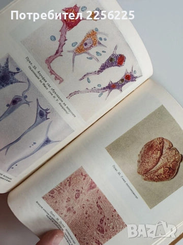 Патологична анатоми, снимка 3 - Специализирана литература - 53124750