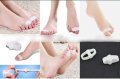 Изпъкнали кокалчета ”hallux valgus”-различни видове, снимка 14