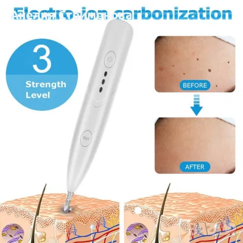 Уред за премахване на петна,бенки,брадавици,татуировки и др. с лазерно-йонна техника, снимка 2 - Други - 48250620