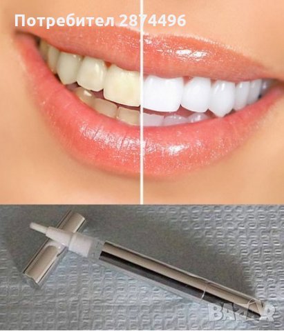 0745 Писалка за избелване на зъби, снимка 5 - Други - 30933817