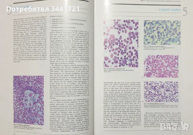 Атлас и наръчник по аспирационна цитология /Manual and Atlas of Fine Needle Aspiration Cytology, снимка 8 - Специализирана литература - 47891625