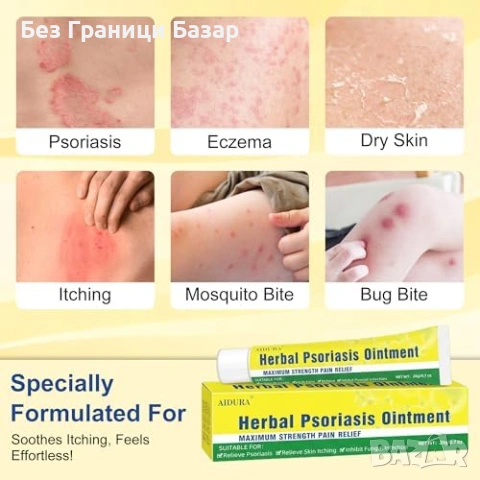 Нов Интензивен крем за суха кожа псориазис екзема лице и тяло Хидратиращ против сърбеж, снимка 3 - Други - 53973345