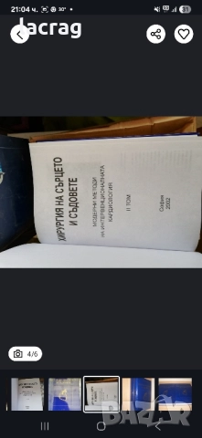 Хирургия на сърцето и съдовете - проф.Ал.Чирков, снимка 1