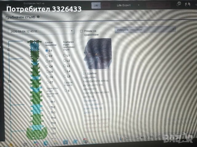 Биорезонанс - диагностика и терапия , снимка 5 - Медицински, стоматологични - 54220027