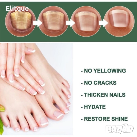 Лак на маслена основа против гъбички по ноктите 30ml, снимка 2 - Други - 52459580