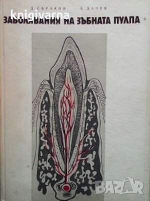 Заболявания на зъбната пулпа Д. Свраков, снимка 1