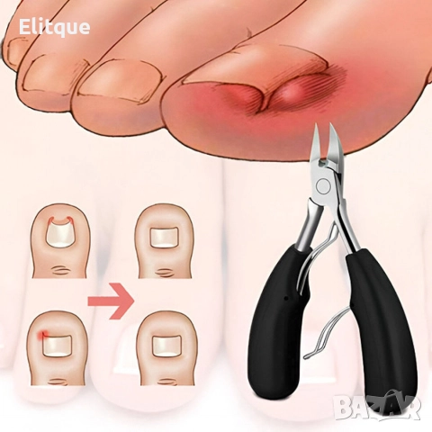 Професионален комплект за поддръжка на нокти – 5 части от неръждаема стомана, снимка 2 - Други - 52853040