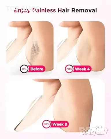 Нов Професионален IPL уред за лице и тяло, безболезнено премахване на косми, снимка 5 - Тримери - 49239132